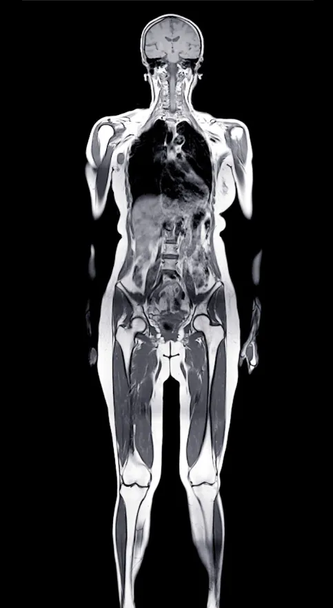 Prenuvo longevity clinic in San Francisco, United States